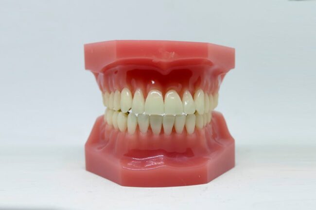 Tooth Extractions When and Why They Are Necessary for Optimal Oral Health