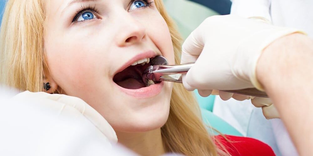 tooth extractions tooth extractions