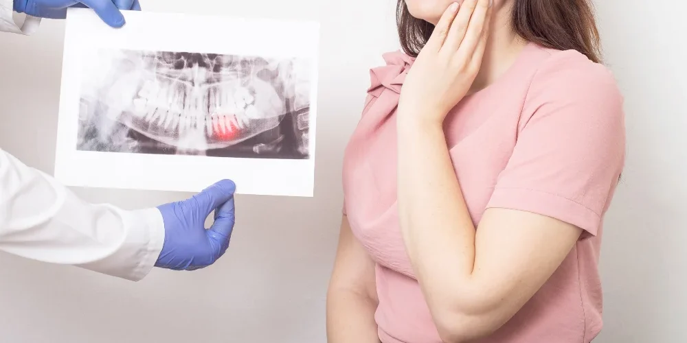 About Wisdom Teeth Removal