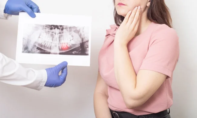 About Wisdom Teeth Removal