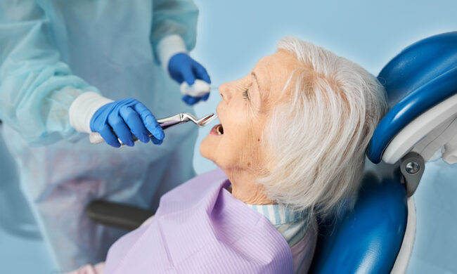 Wisdom Teeth Removal